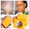 AILKE Organic Turmeric Soap Bar, Whiten, Reduce Acne, Pimples, Blackheads, Brightening, Clean Skin, Even Skin Tone