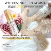 AILKE Bleaching Brightening Skin Tone Body Lotion, Suitable Knuckle, Elbow, Leg, Korean Skin Care Cosmetic 24 Hours Moisturizing