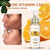 AILKE Lightening Body Cream, with Vitamin C, Hyaluronic Acid, Shea Butter, Uneven Skin Tone, Deeply Hydration